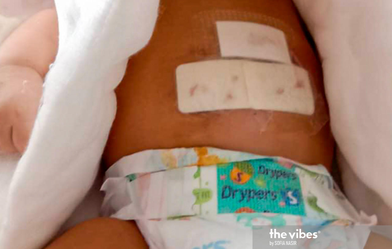 The baby is recovering from injuries to his head, abdomen, and face. – SOFIA NASIR/The Vibes pic, January 11, 2021
