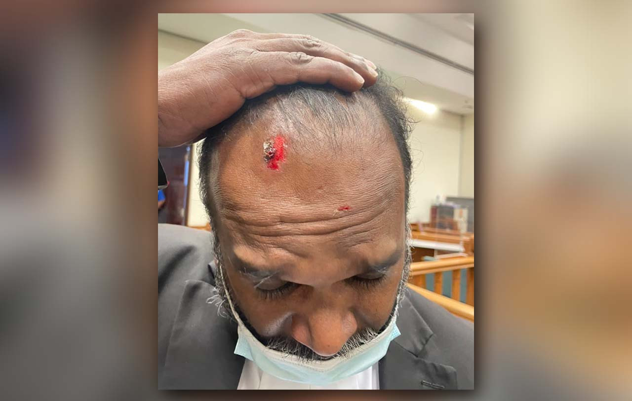 Both men have received outpatient treatment at Shah Alam Hospital, as the photographer sustained injuries to his neck and arms, and the lawyer (pic) was injured on his forehead. – The Vibes Reader pic, June 22, 2022