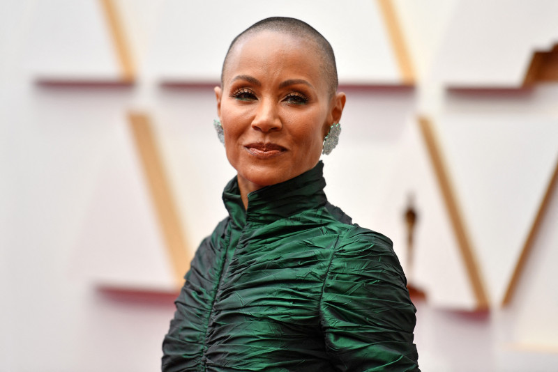 Hair loss: women speak of the pain of going bald