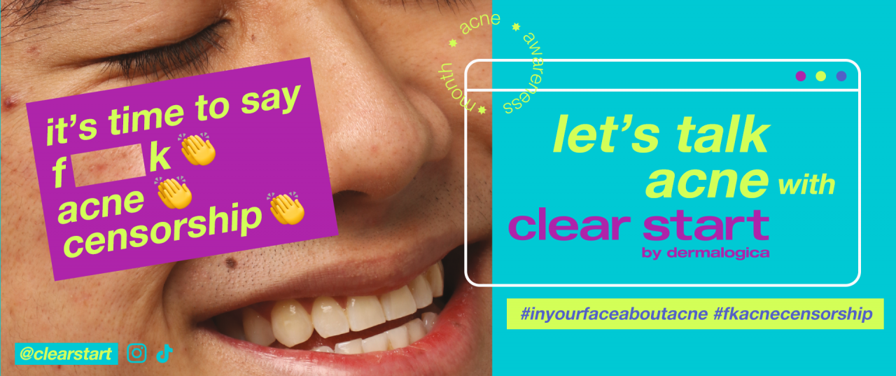 #FkAcneCensorship: Clear Start campaign is introduced by Dermalogica to normalise the conversations surrounding acne. – Pic courtesy of Dermalogica