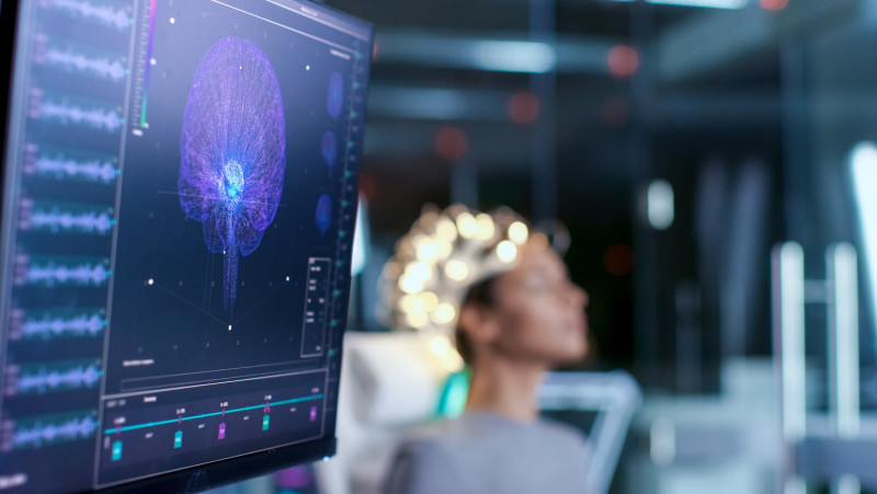 The race to link our brains to computers is hotting up