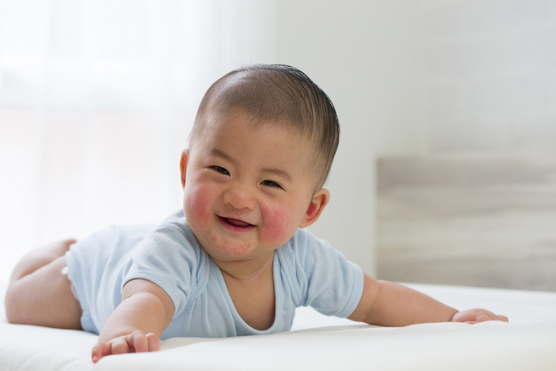 Managing the itch: what parents should know about childhood eczema
