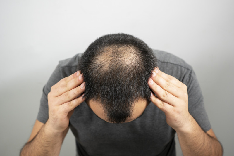 If you’re worried about hair loss, it could be time to quit sugary drinks
