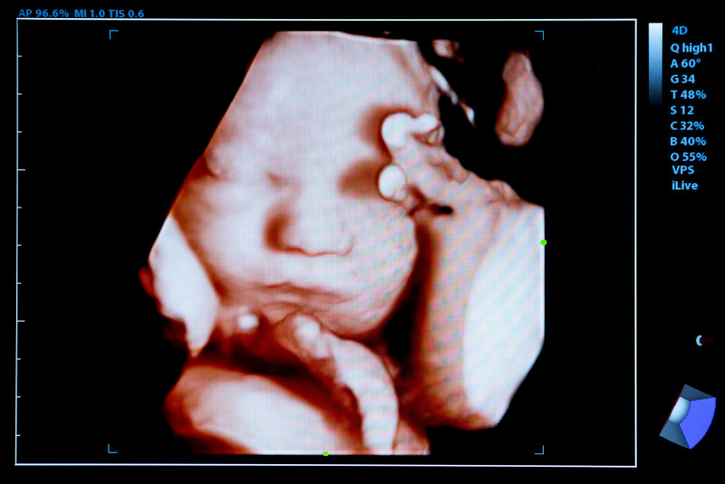 Babies in the womb react differently to flavours: researchers