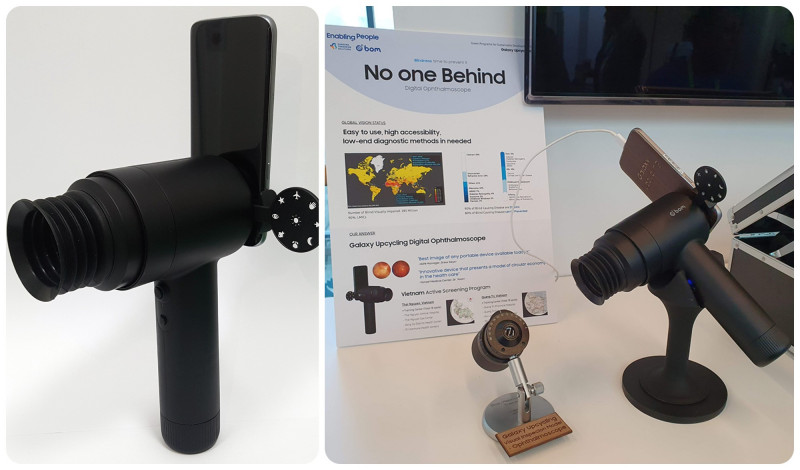 Samsung’s Eyelike fundus camera repurposes Galaxy smartphones 