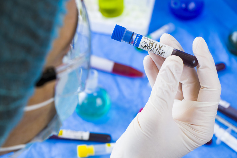 HIV ‘significant’ risk factor for severe Covid: WHO