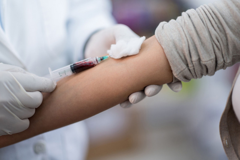Japan approves Alzheimer's blood test kit
