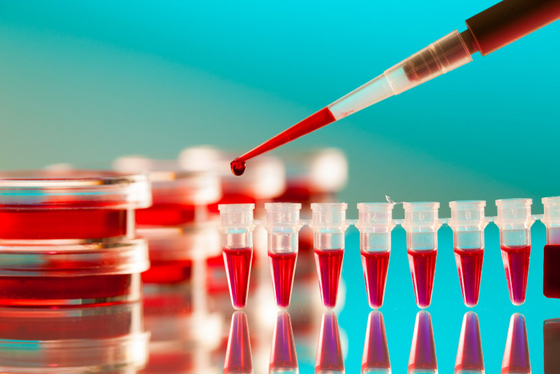 HIV infection rates not decreasing fast enough: UNAIDS