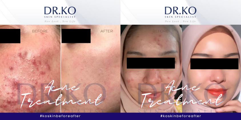 Treatment at Dr. Ko Skin Specialist is tailor-made to each individual so that it can work the best according to that individual’s physical condition and medical history. — Dr. Ko Skin Specialist pic