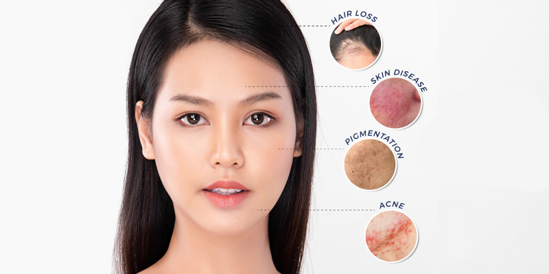 Stress and self-care: Are you treating your skin and hair right?