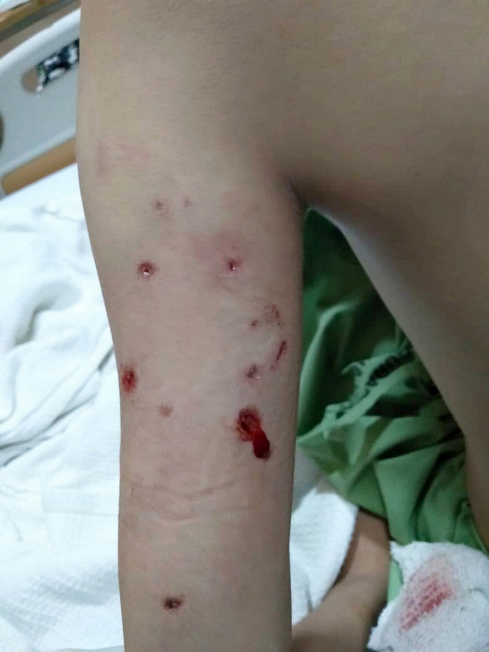 Syauqina Rifqa Sarnizam had just come home from religious school when she saw dogs lurking near her pet rabbit’s cage. – Bernama pic, April 14, 2021