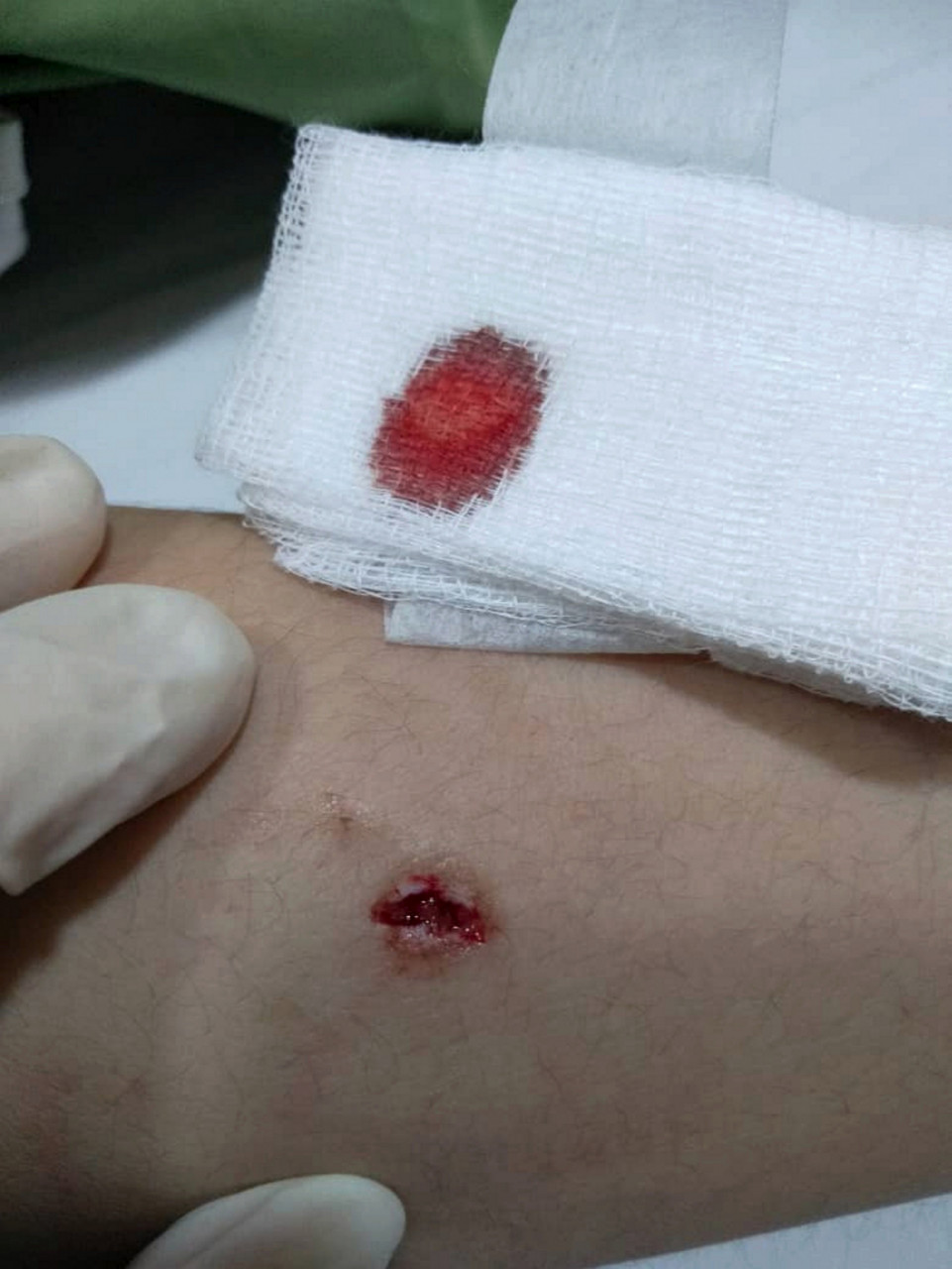 The dogs bit Syauqina on the head, left arm, right leg and back. – Bernama pic, April 14, 2021