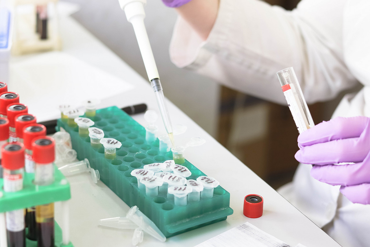 Under the Regional Comprehensive Economic Partnership, provisions related to intellectual property seek to extend pharmaceutical corporations’ patent terms beyond the 20-year period accepted internationally and enforce data exclusivity that limits competition. – Pixabay pic, July 5, 2021