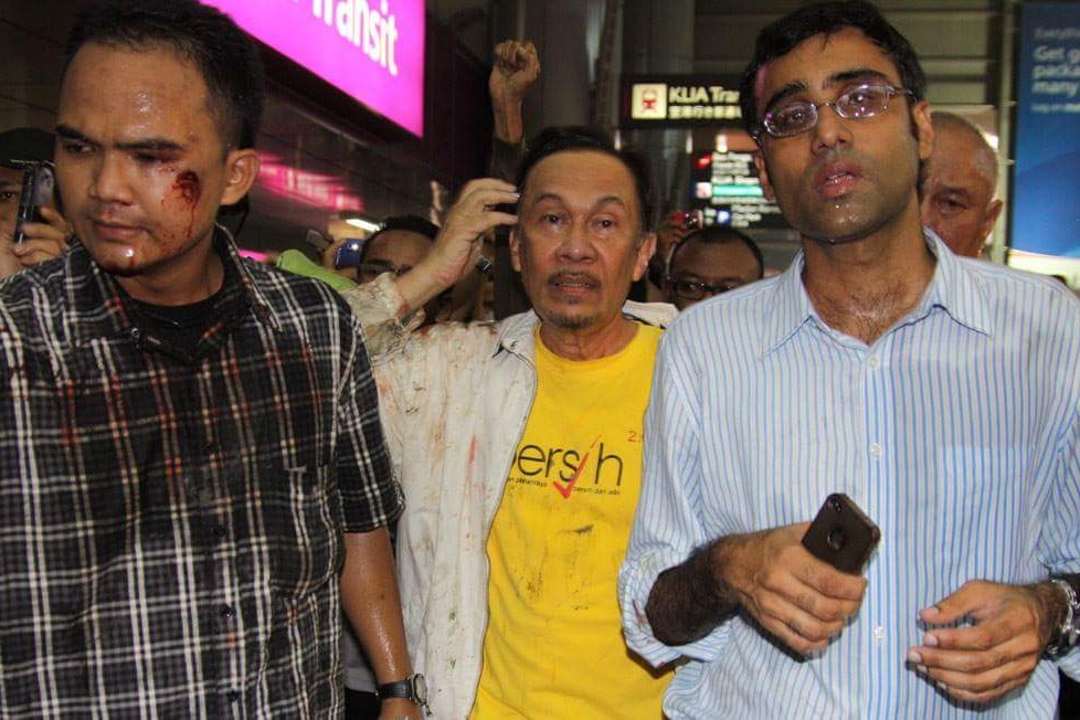 Several people were injured during the 2011 rally, including opposition chief Datuk Seri Anwar Ibrahim’s bodyguard, who fractured his cheekbone when a tear-gas canister was shot directly at his face. – Anwar Supporters Twitter pic, July 11, 2021