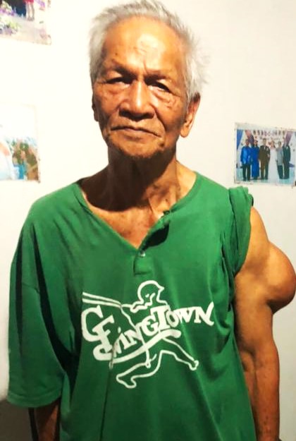 Stateless senior citizen Purait Arun (pic) has developed a large tumour on his left arm in the last 10 years and requires urgent treatment, says health activist Agnes Padan. – Pic courtesy of Agnes Padan, February 3, 2023