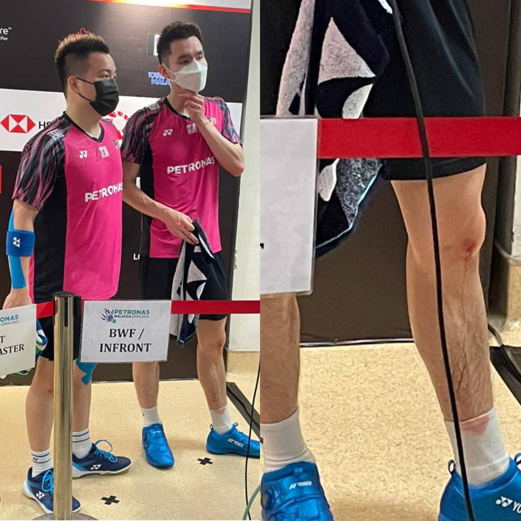 Soh Wooi Yik was unphased by an injury to his left knee. – SAKTESH SUBRAMANIAM/The Vibes, June 30, 2022