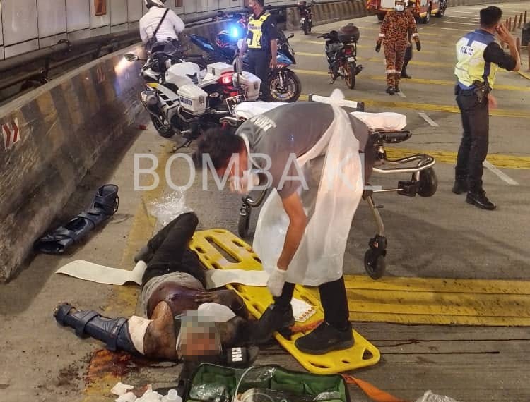 Fire Department officials say the male victim, aged 22, suffered injuries to his right hand. – KL Fire and Rescue Department pic, June 26, 2022
