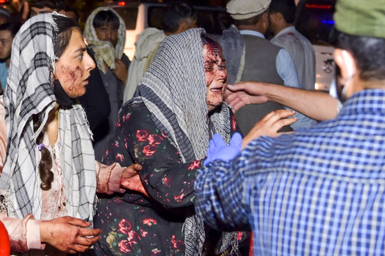 Afghan women injured in the attack at Kabul airport yesterday. – AFP pic, August 27, 2021