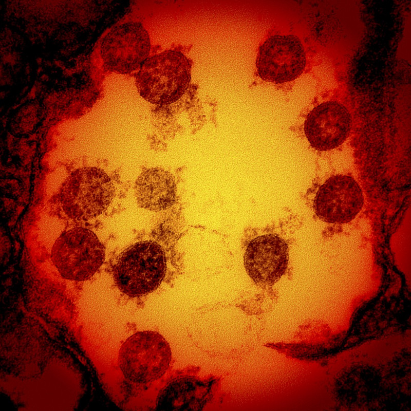 Second Covid-19 trial paused within 24 hours