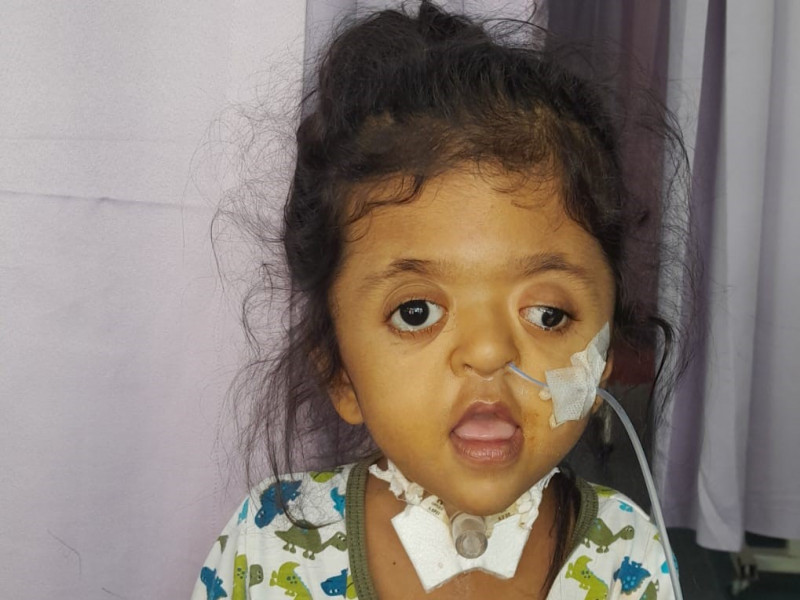 32-month-old toddler in urgent need of help for corrective surgery
