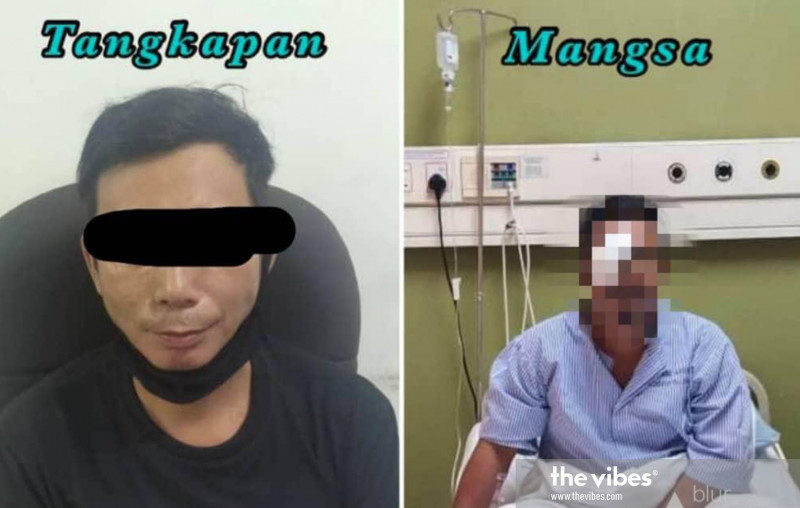 Drunken brawl leaves Sabahan permanently blinded in right eye