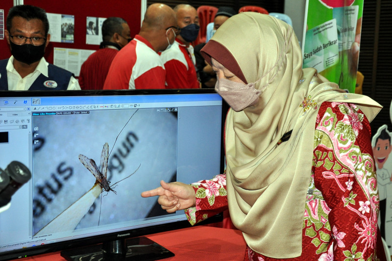 Terengganu records over 900 HFMD cases: state health director