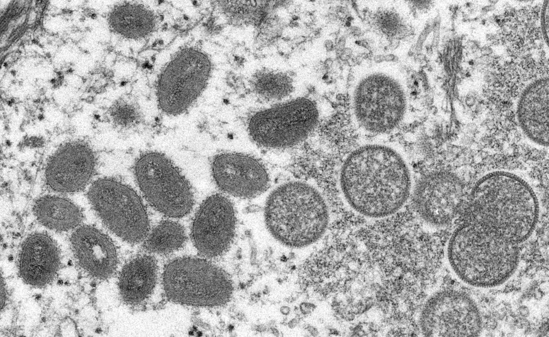 Thailand confirms first monkeypox case
