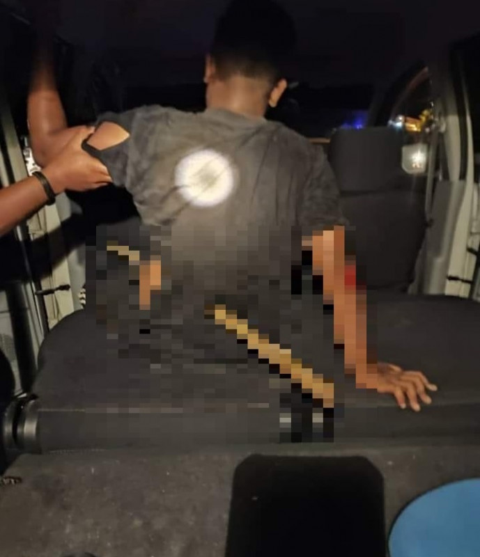 Bamboo stem goes right through teen’s abdomen in Gua Musang accident