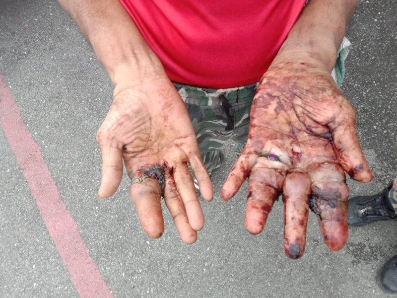 Fire Dept called to ‘rescue’ man with hand injuries 