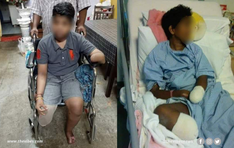 Ampang Hospital hit with negligence suit after teen undergoes 4 amputations