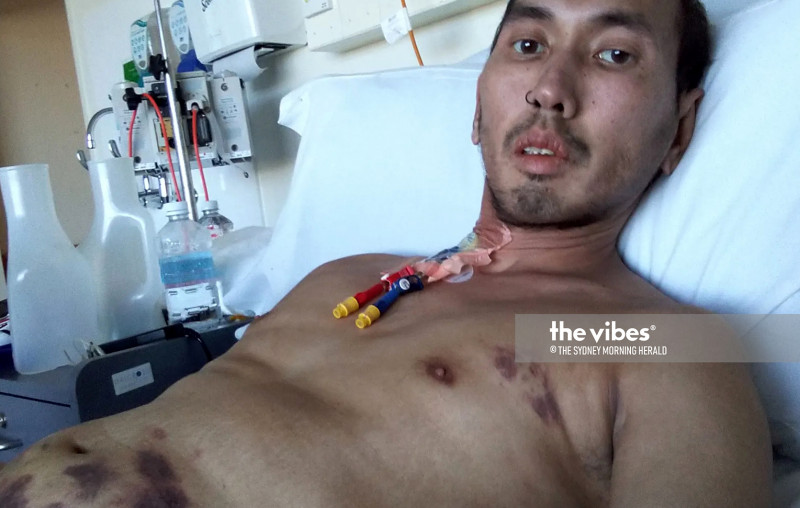 ‘Loneliest’ M’sian in Sydney hospital says reports on him inaccurate: Wisma Putra