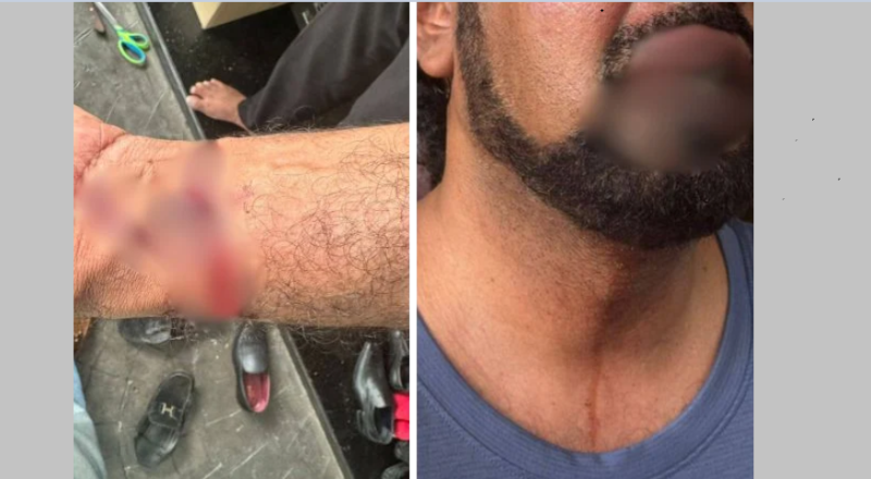 Key witness in Guan Eng's corruption trial attacked by 10 armed men