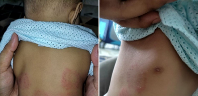 Nanny held under remand over bite marks, bruises on two children