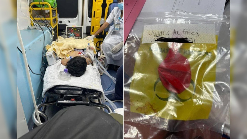 Boy nearly dies after balloon lodges in airway during birthday celebration
