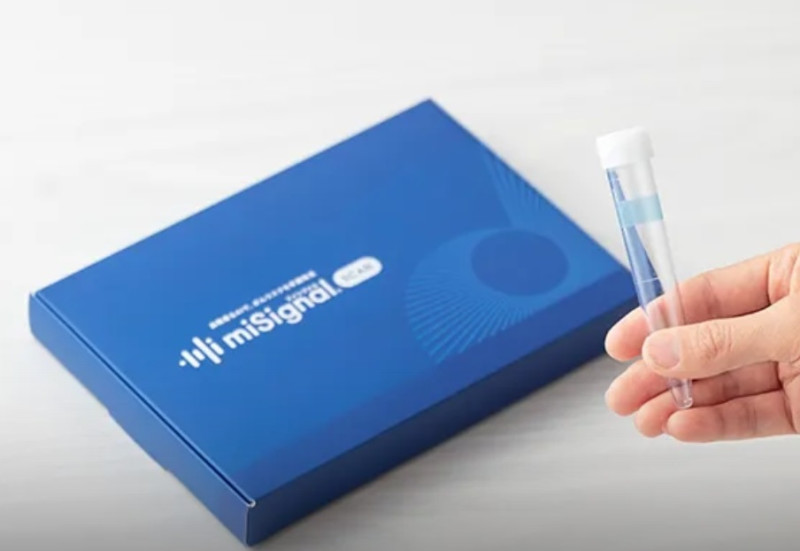 Japanese startup’s urine-based cancer test shows early detection potential