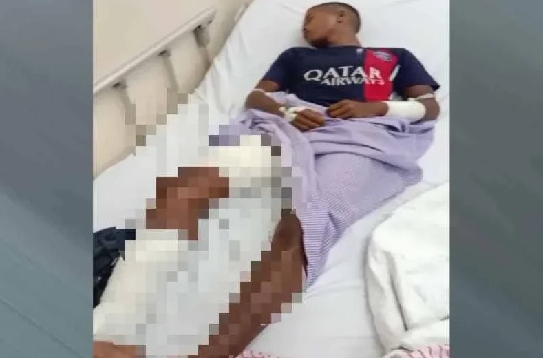 Gua Musang youth injured in bear attack while foraging in forest