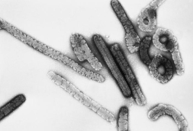 Ghana reports first cases of deadly Marburg virus