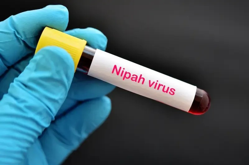 Woman dies from Nipah virus in northern Bangladesh amid regional cases - WHO | World | The Vibes