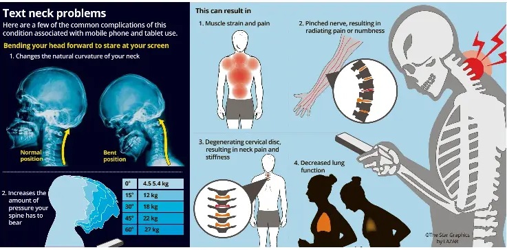 Text Neck: The digital age syndrome plaguing Malaysian youth