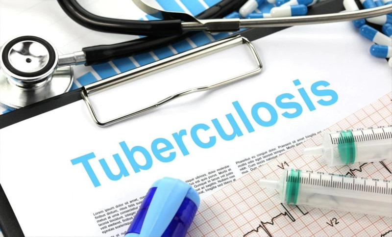 Health expert warns of heightened TB risk during festive season gatherings