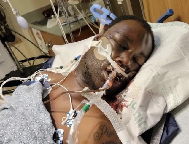 Five US cops charged with beating black man to death