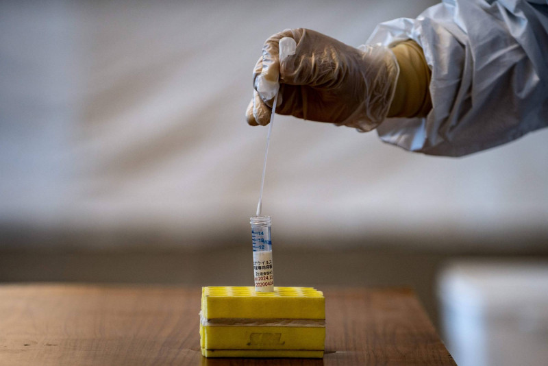 Tokyo asks China to end Covid-19 anal swabs for Japanese