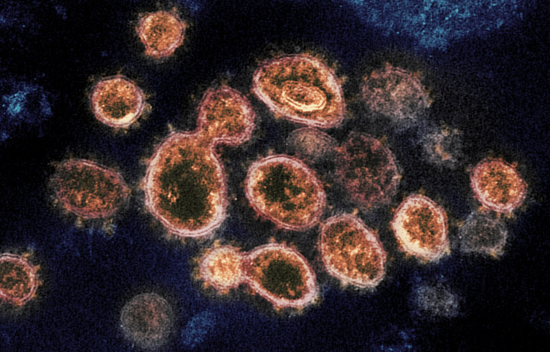 265 Delta variant cases detected in past 2 weeks: Noor Hisham