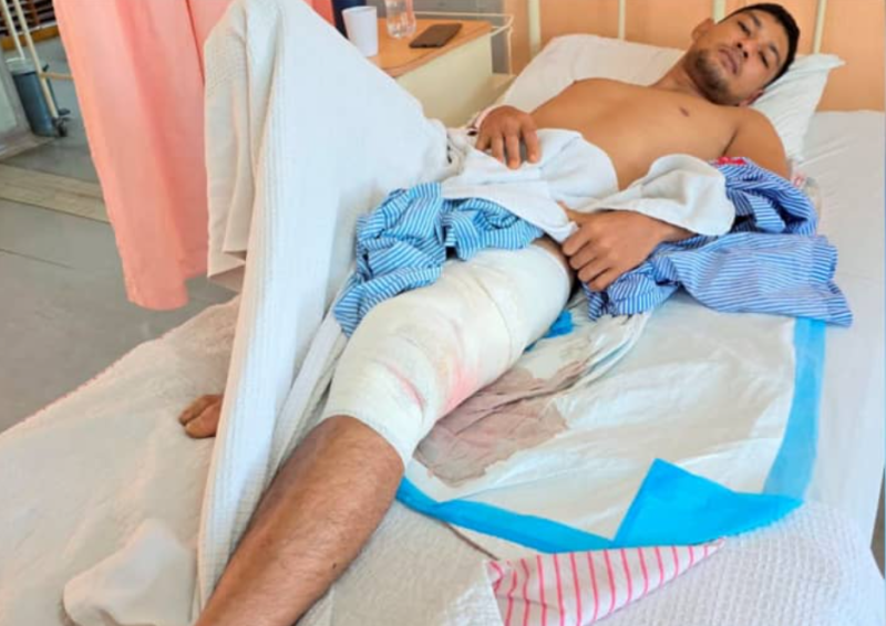 Groom to be survives crocodile attack while out fishing