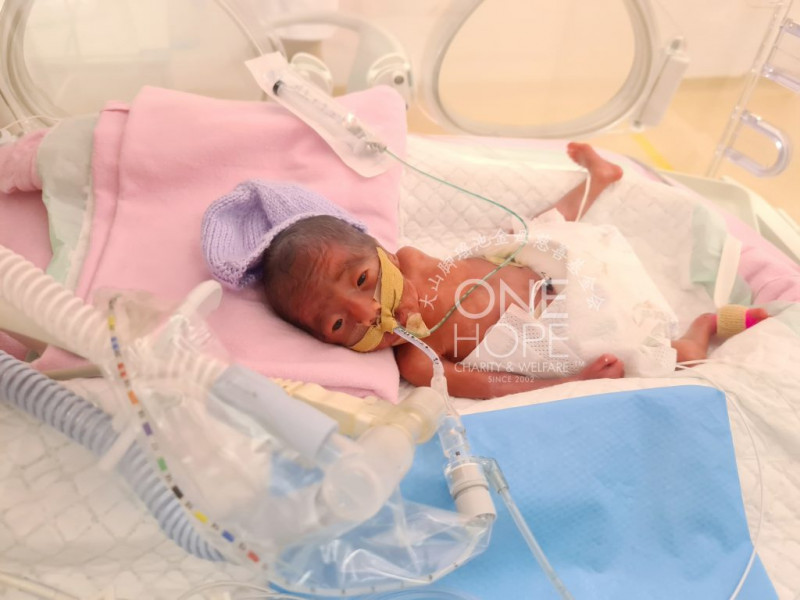 RM1.2 mil raised in 29 hours for premature M’sian baby born in S’pore