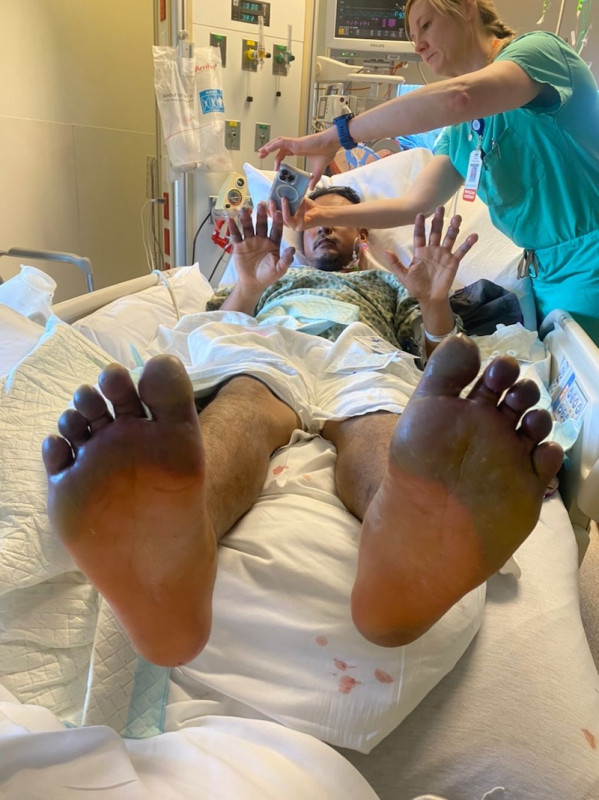 Mt Denali climber says lucky to be alive