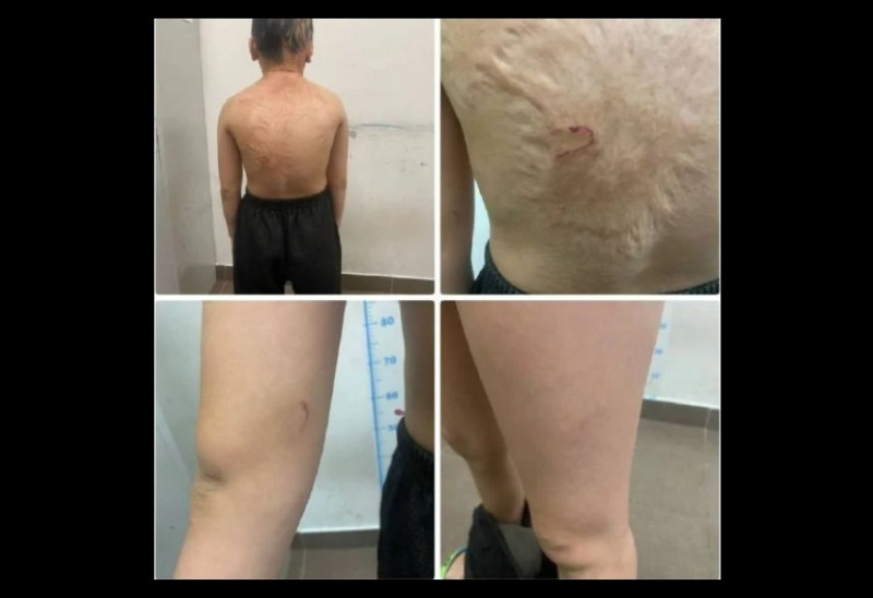 10-year-old child found abandoned, shivering, believed to have been abused